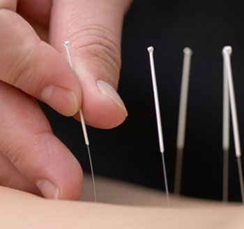 Čínská medicína léčí lépe a levněji, říká šéf hradecké nemocnice. 