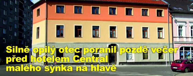 Silně opilý otec poranil pozdě večer před hotelem Central malého synka na hlavě