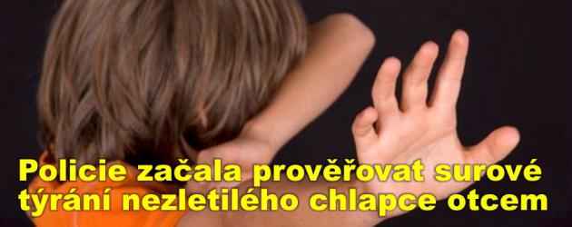 Policie začala prověřovat surové týrání nezletilého chlapce otcem v Hlinsku